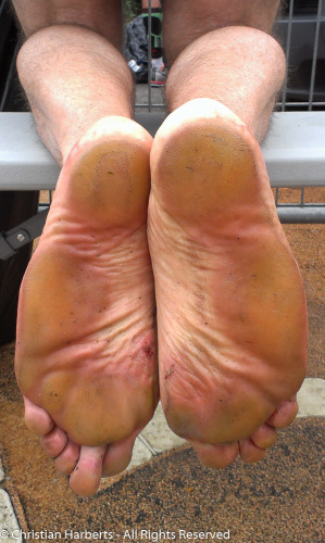 Pieds de marathonien pieds nus ;-)