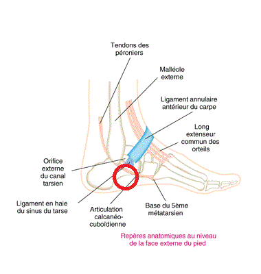 Là ou ça fait mal (cercle rouge) "Repères anatomiques au niveau de la face externe du pied."   Source : site Danse Pour Tous, page "Anatomie et probleme du pied"  https://dansepourtous.e-monsite.com/pages/sante/anatomie-et-probleme-du-pied.html