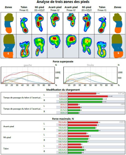 analyse-leurion-barefooting-07